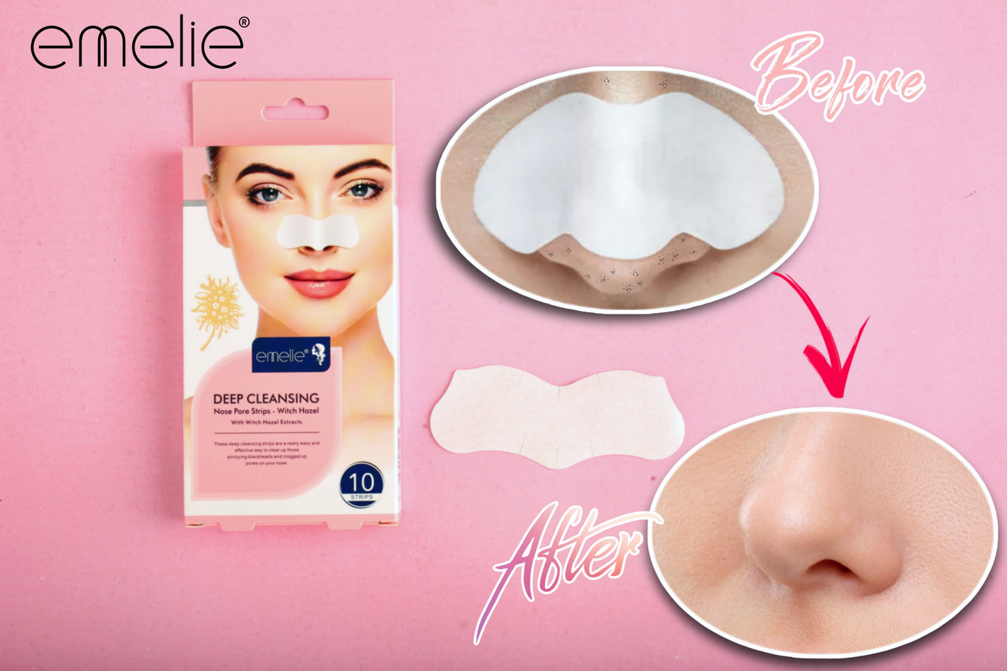 Emelie Nose Strips