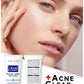 Meon Acne Clear Facial Foam Face Wash